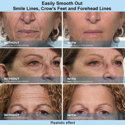 ✨ Buy 1 Get 1 FREE for the next 3 hours only! ✨ Instant Face Temporary Tightener – Instant visible results in just 30 seconds.